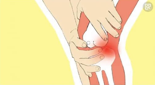 膝盖疼怕凉是关节炎吗?受凉膝盖疼是怎么回事?