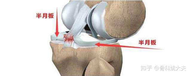 爬楼梯膝盖就疼，这究竟是怎么回事？