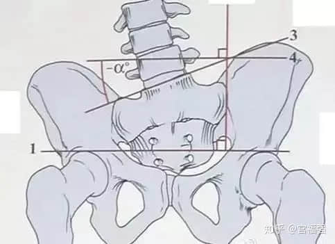 跷二郎腿,是怎么让人悄悄“变丑”的?